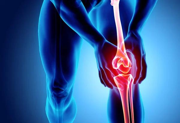 Houston knee doctor trusted for advanced knee pain treatment